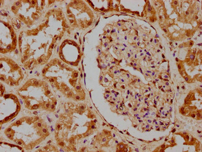 PKN3 Antibody
