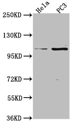 PKN3 antibody