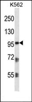 PKP2 antibody