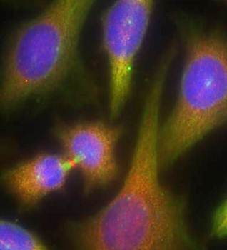PKR (Ab-451) Antibody