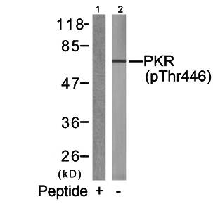 PKR (Phospho-Thr446) Antibody