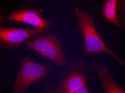 PKR (Phospho-Thr446) Antibody