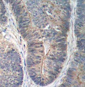 PKR (Phospho-Thr451) Antibody