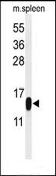 PLA2G1B antibody