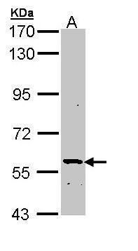 ATP6V1H antibody