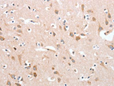 PLA2G4A Antibody