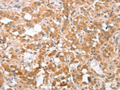 PLA2G4A Antibody