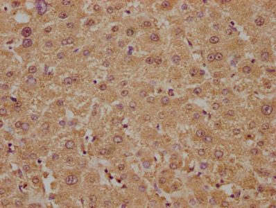 PLA2G4B Antibody