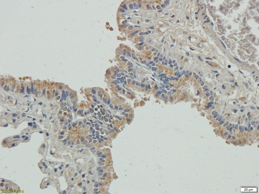 PLA2G5 antibody