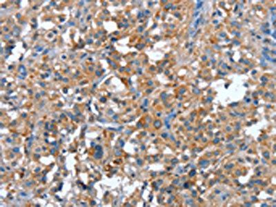 PLA2G6 Antibody