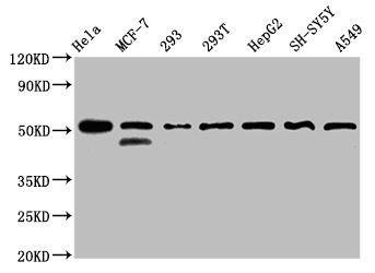 PLAGL1 Antibody