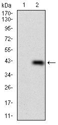 PLAGL1