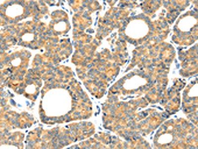 PLAGL2 Antibody