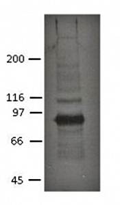 Plakophilin 2 Monoclonal Antibody