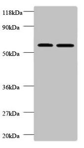 Plasma alpha-L-fucosidase antibody