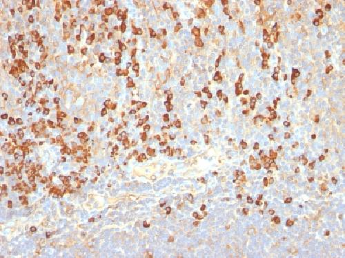 Plasma Cell Marker Antibody