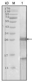 PSA (KLK3) Antibody