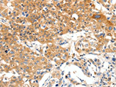 PLAT Antibody