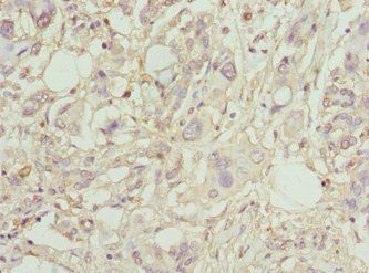 PLA2G7 Antibody
