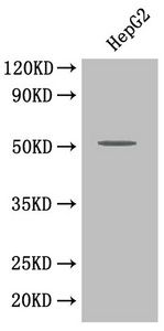 Platelet-activating factor acetylhydrolase antibody