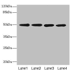 Platelet-activating factor acetylhydrolase antibody