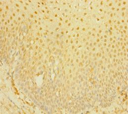 PLA2G7 Antibody