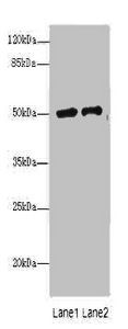 Platelet-activating factor acetylhydrolase antibody