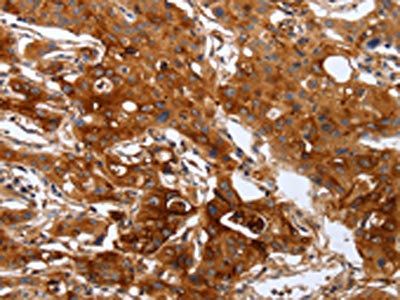 PLAUR Antibody