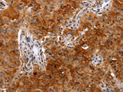 PLAUR Antibody