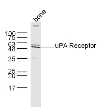 PLAUR/uPAR antibody
