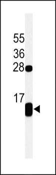 PLB-T17 antibody