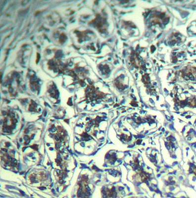 PLC-γ1 (Ab-771) Antibody