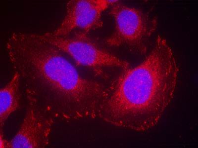 PLC-γ1 (phospho-Tyr771) Antibody