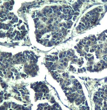 PLC-γ2 (phospho-Tyr1217) Antibody