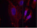 PLCγ2 (Phospho-Tyr753) Antibody