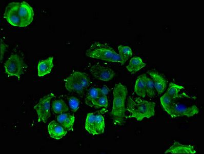 PLCB1 Antibody