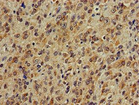 PLCB1 Antibody