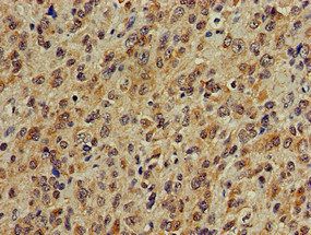 PLCB1 antibody