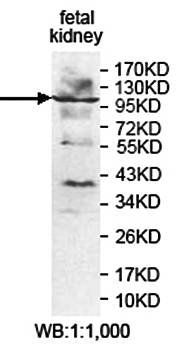 PLCB2 antibody