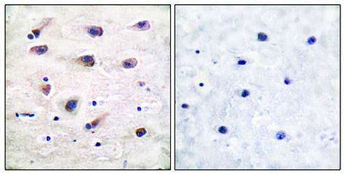 PLCB3 (Phospho-Ser1105) Antibody