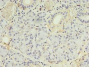 PLCD4 Antibody