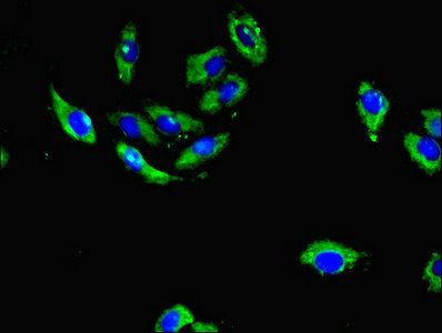 PLCD4 Antibody