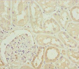 PLCD4 Antibody