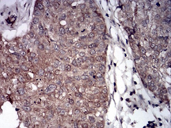 PLCG1 Antibody