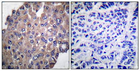 PLCG1 (phospho-Tyr771) antibody