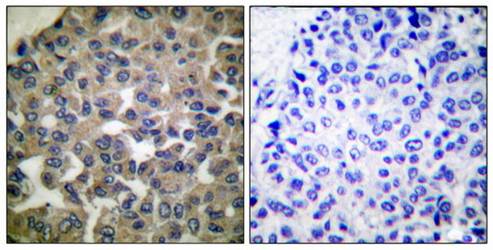 PLCG1 (Ab-771) Antibody
