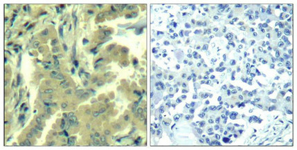 PLCG2 (Ab-1217) Antibody