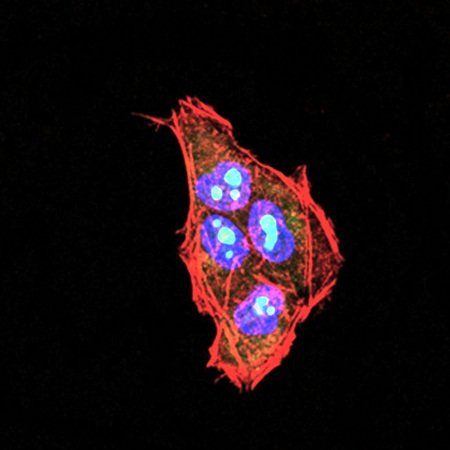 PLCG2 Antibody