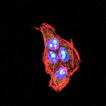 PLCG2 Antibody