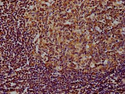 PLCG2 Antibody